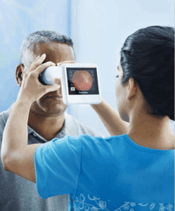 Diabetes Retinopathy